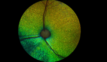 animal fundus3