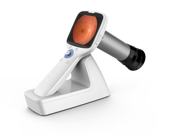 hand held fundus camera