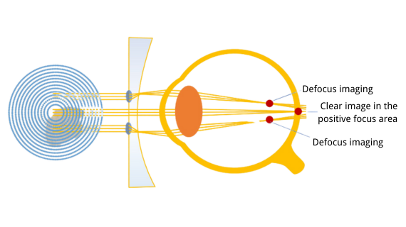 Defocus imaging